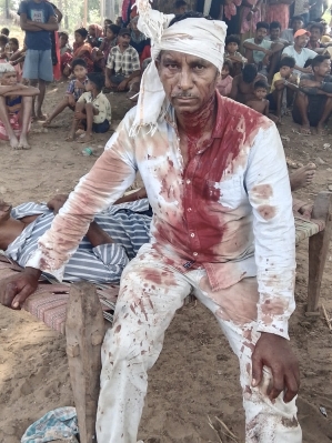 Anti-Christian hostilities in India increase over prior years Sukra Madi was beaten for his faith on June 21, 2025 in Kotamateru village, Malkangiri District, Odisha state, India.